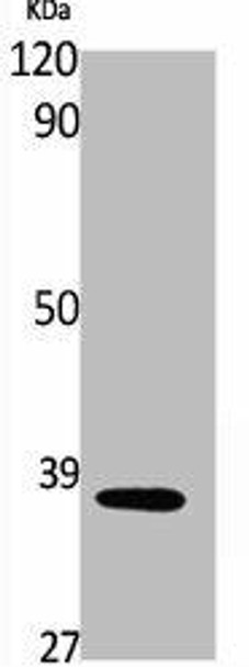 Phospho-ANXA1 (Y21) Antibody (PACO00335)