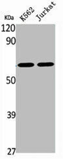 SLC22A17 Antibody (PACO01781)