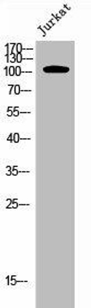 Phospho-EPHA7 (Y791) Antibody (PACO02652)