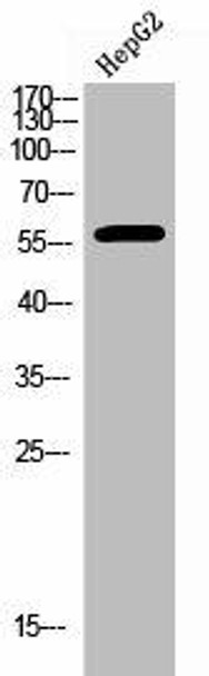 Phospho-ESR2 (S105) Antibody (PACO02676)