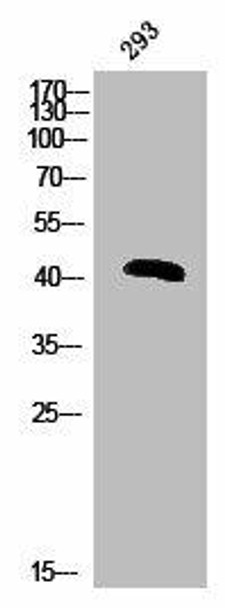 Phospho-HNRNPC (S260) Antibody (PACO02814)