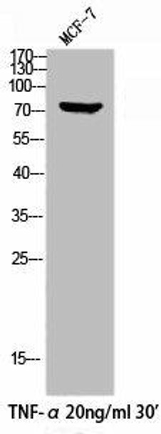 Phospho-HSF1 (S303) Antibody (PACO02819)
