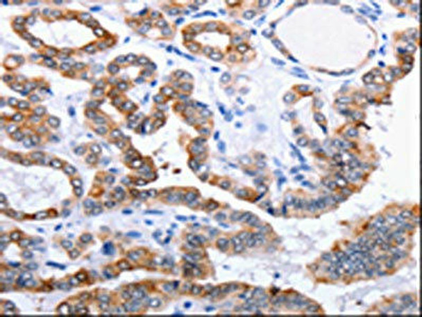 CCND1 Antibody (PACO17763)