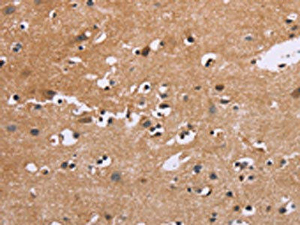 EGR4 Antibody (PACO17823)