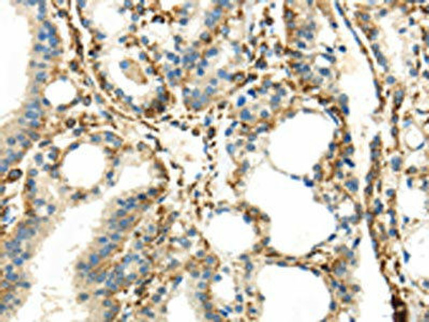 IQGAP2 Antibody (PACO18108)