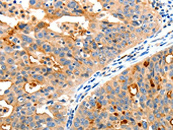 MAP2K2 Antibody (PACO18188)