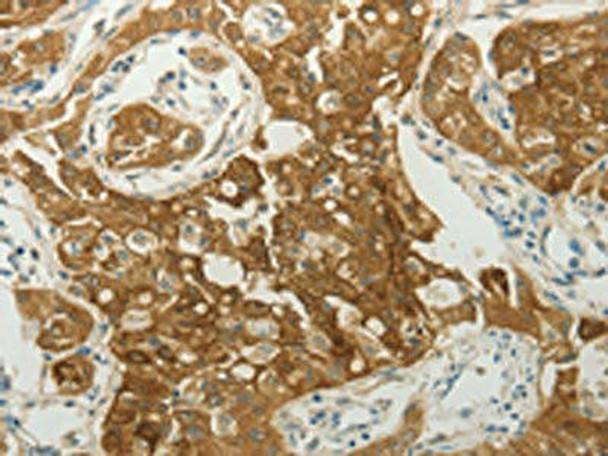 MC4R Antibody (PACO18197)