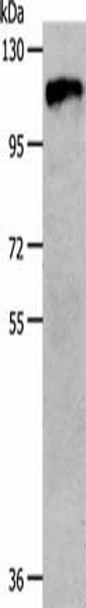 CSF1R Antibody (PACO18212)