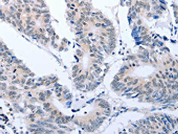 RASSF1 Antibody (PACO18380)