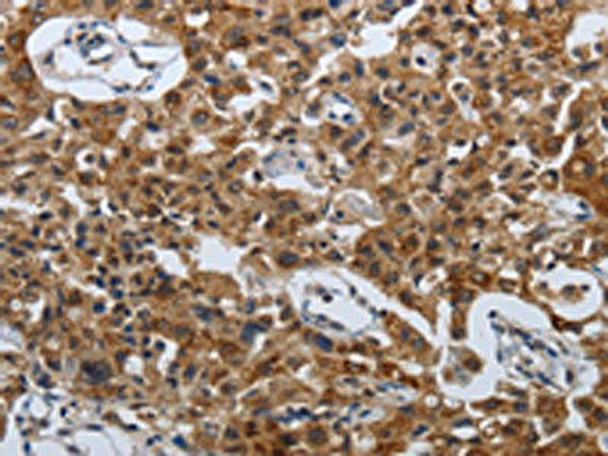 SPAG4 Antibody (PACO18426)