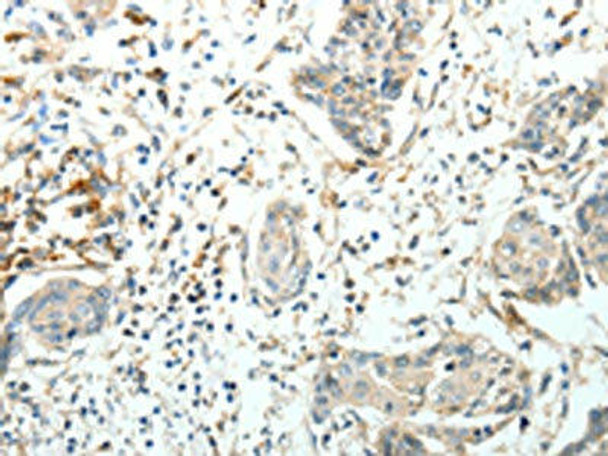 FZD3 Antibody (PACO18493)