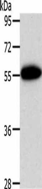 AGT Antibody (PACO18557)