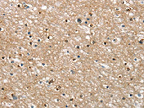 APOC4 Antibody (PACO18579)