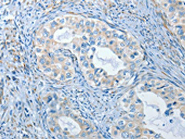 PRKG2 Antibody (PACO18631)