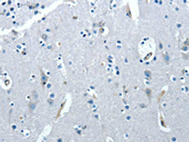 PRKX Antibody (PACO18643)