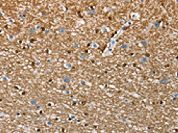 CEACAM6 Antibody (PACO18696)