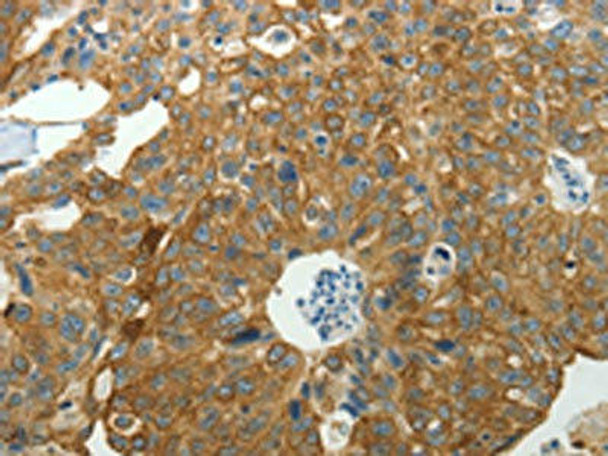 NDRG2 Antibody (PACO18731)