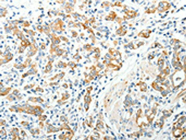 TEP1 Antibody (PACO18967)