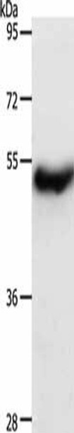 CERS2 Antibody (PACO19003)