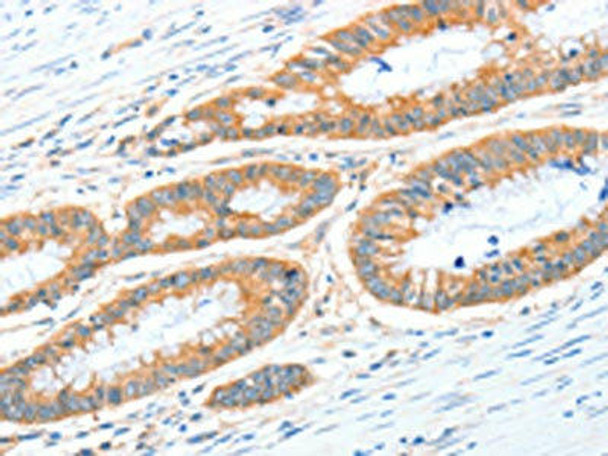 ALDH1A2 Antibody (PACO19083)