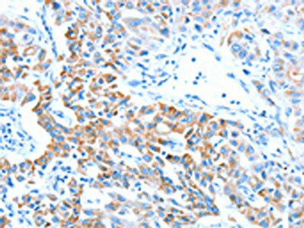 ALDH5A1 Antibody (PACO19086)