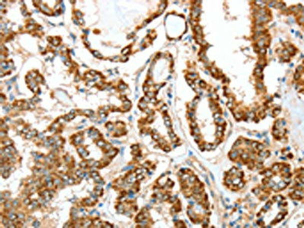 ALDH9A1 Antibody (PACO19089)