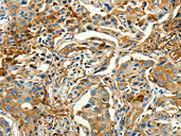 CALCA Antibody (PACO19218)