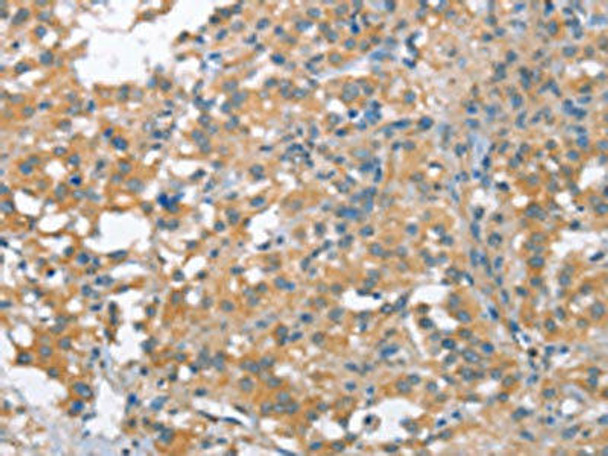 NLRP7 Antibody (PACO19305)