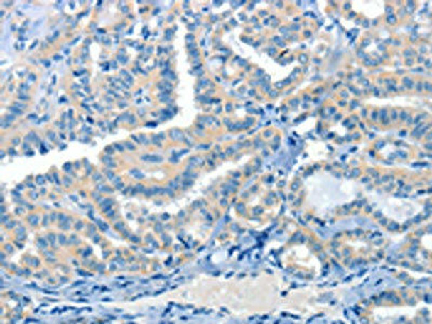 CRLF2 Antibody (PACO19495)