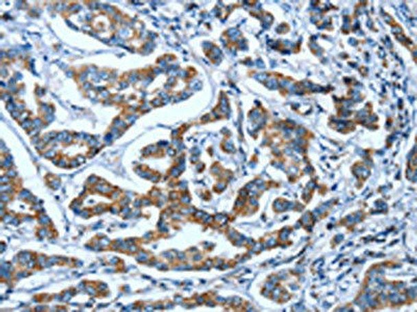 OPRD1 Antibody (PACO19560)