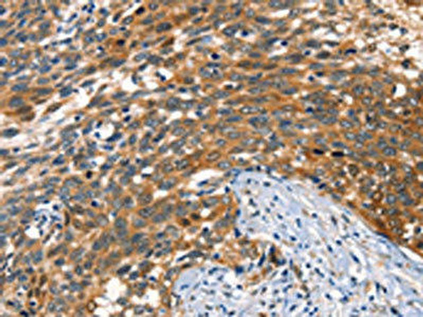 AGO1 Antibody (PACO19590)