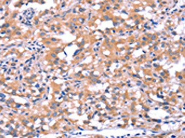 FAT1 Antibody (PACO19647)