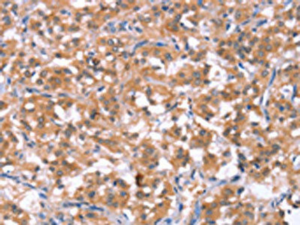 HCAR2 Antibody (PACO19728)