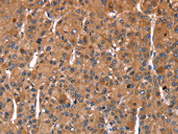 HMGCS1 Antibody (PACO19765)