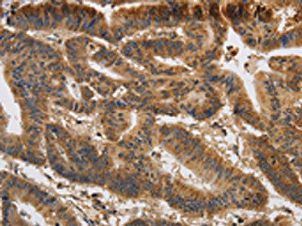 KCNK9 Antibody (PACO19886)