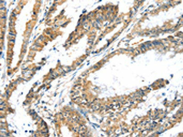 LZTS1 Antibody (PACO19962)