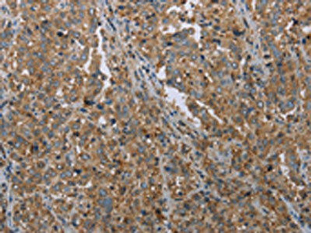 MDFIC Antibody (PACO20000)