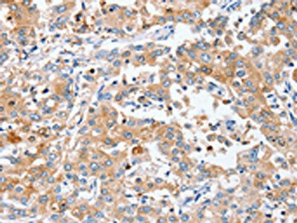 PPOX Antibody (PACO20270)