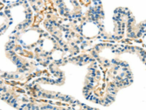 SPDL1 Antibody (PACO20598)