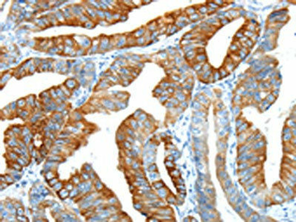 F2 Antibody (PACO20678)