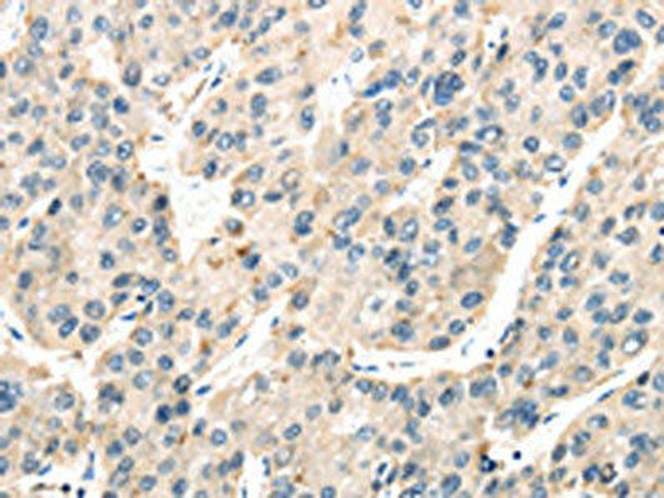 TXNIP Antibody (PACO20800)