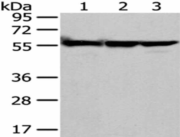 FYN Antibody (PACO20893)