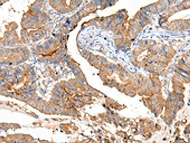 MUC1 Antibody (PACO20981)