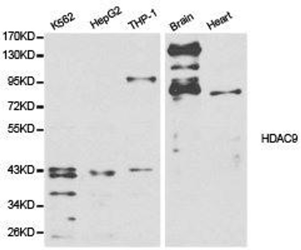 HDAC9 Antibody (PACO21144)