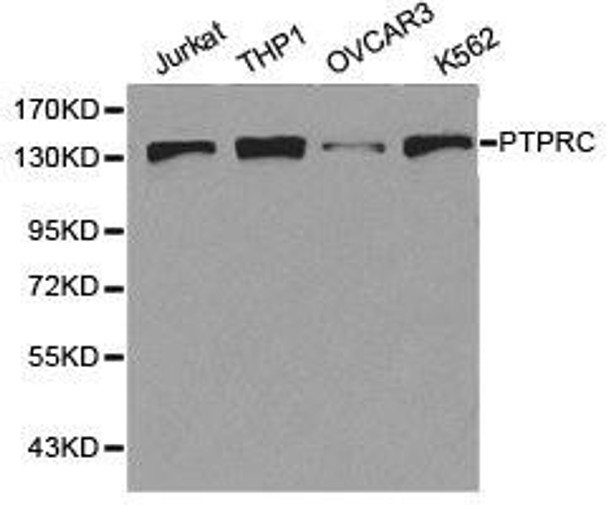 PTPRC Antibody (PACO21253)