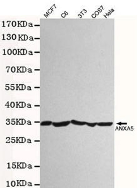 ANXA5 Antibody (PACO21347)