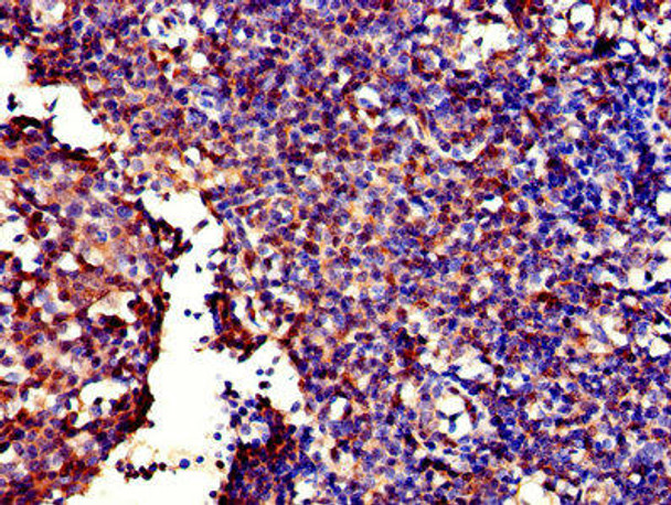 GALT Antibody (PACO26913)