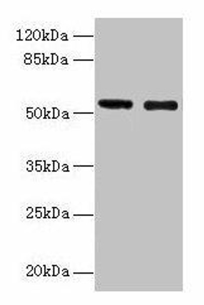 GLP1R Antibody (PACO27029)