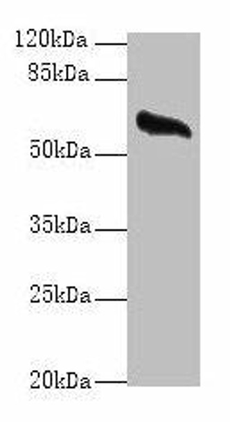 GPC4 Antibody (PACO27133)