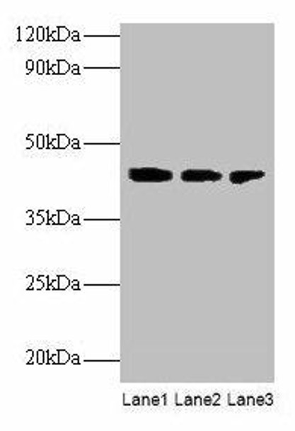 ILKAP Antibody (PACO27637)